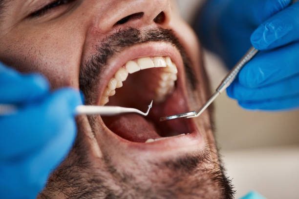 Best Walk-In Emergency Dental Services in Renovo, PA